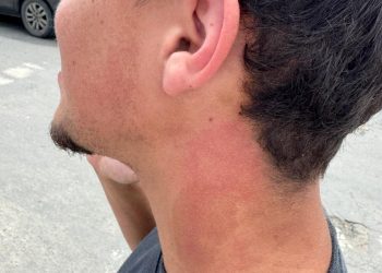 Suposta  agressão durante eleição de Bairro em Planalto Serrano gera denúncia