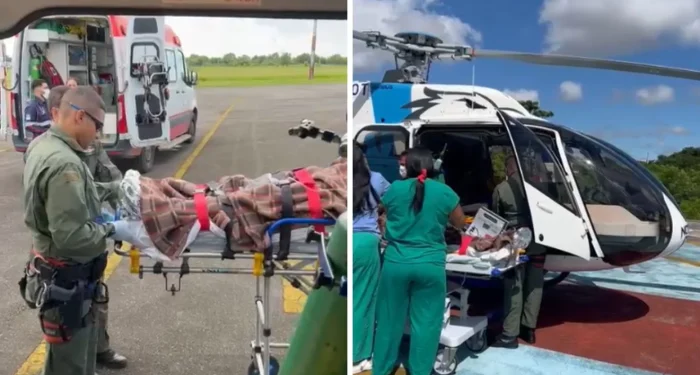 Vendedor ambulante sofre queimaduras graves após explosão de botija de gás em São Mateus